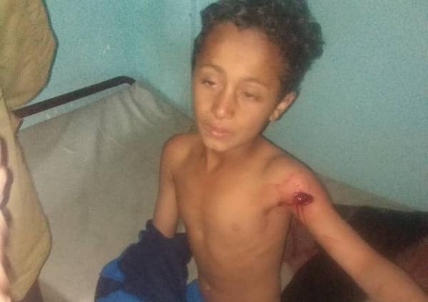إصابة طفلين برصاص قناص حوثي جنوبي تعز