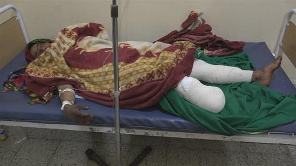 تعز.. إصابة امرأة بجروج بليغة بانفجار لغم زرعته مليشيات الحوثي في جبل حبشي