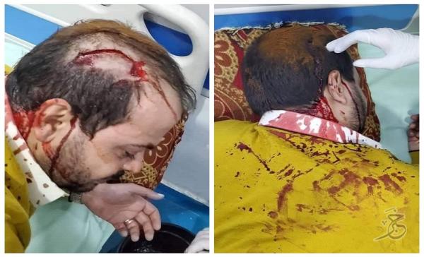 مجاميع حوثية مسلحة تتهجم وتعتدي على رجل الأعمال أحمد الكبوس في صنعاء
