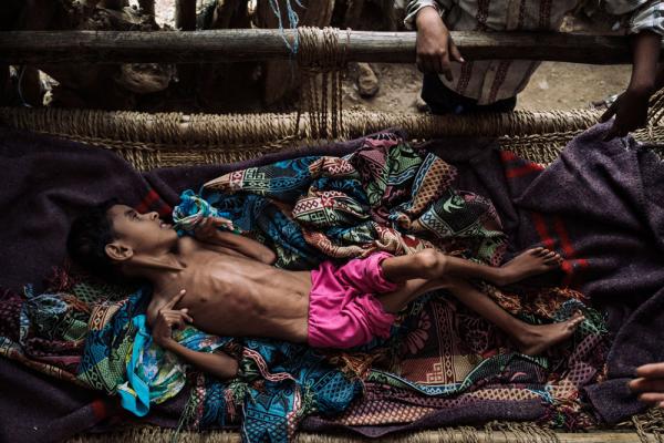 مصادر حقوقية: المنظمات الأممية ومليشيا الحوثي تنهب مليارات الدولارات قُدّمت للجوعى في اليمن