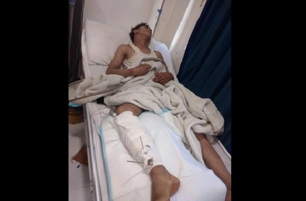 إصابة سائق دراجة نارية بنيران مسلح حوثي في إب