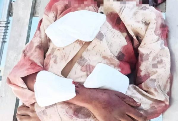استشهاد طفل بقصف مسيرة حوثية استهدف مرفقاً طبياً جنوبي الحديدة  