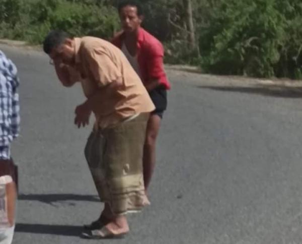 مسلحون حوثيون يعتدون بالضرب المبرح على مواطن في ريمة