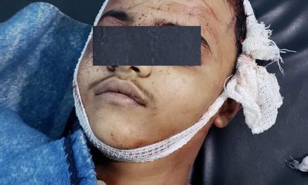 إب.. مقتل طفل على يد متهم بجريمة قتل أفرجت عنه مليشيا الحوثي حديثاً