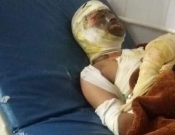 إب: وفاة شاب أحرق نفسه داخل مقر أمن العدين.. وشقيقه يطالب بمحاسبة مدير الأمن وآخرين