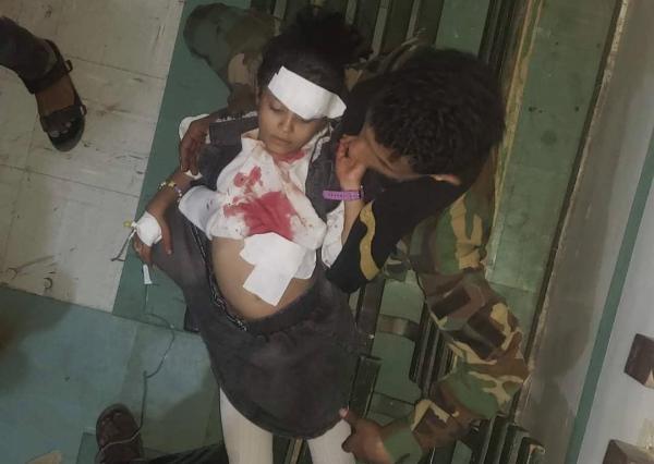 إصابة 12 طفلاً على الأقل جراء قذائف حوثية بتعز