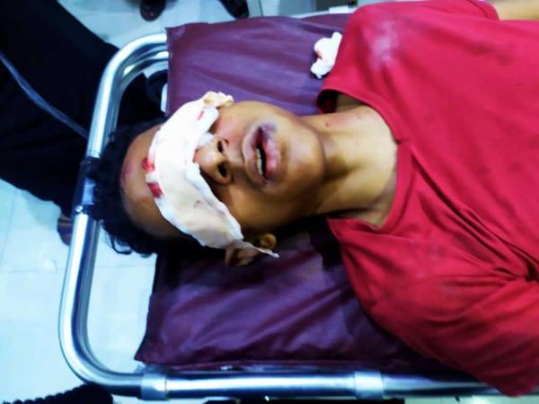 الغضب الشعبي يتنامى في حضرموت ومقتل شابين برصاص قوات أمنية