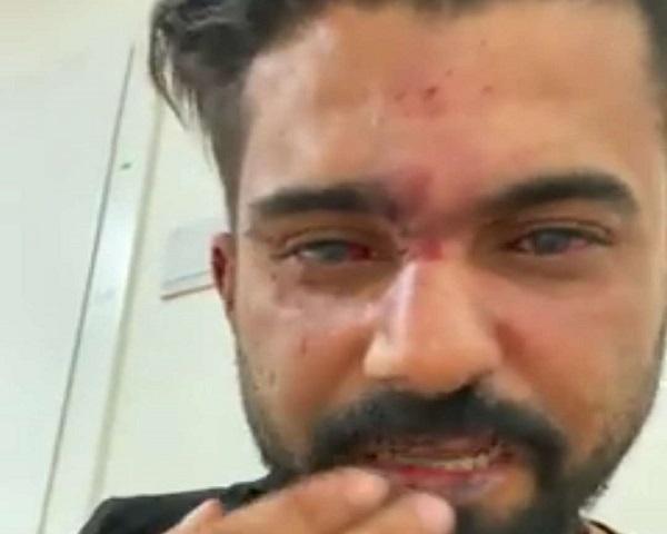 فنان يمني يتعرض للضرب في تركيا