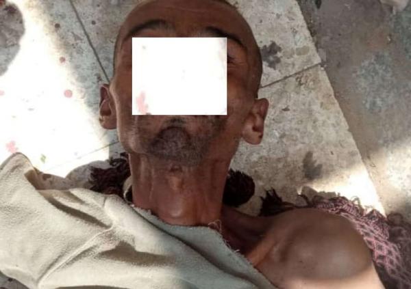 انتحار مواطن في لحج والعثور على جثة آخر في عدن
