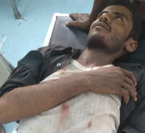الحديدة.. إصابة مواطن بانفجار لغم من مخلفات الحوثيين غداة جرح طفل بحيس