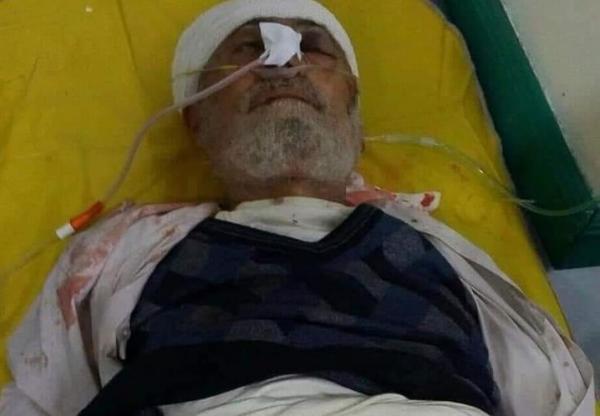 وفاة مُسن متأثراً بإصابته برصاص قناص حوثي شمال مدينة تعز