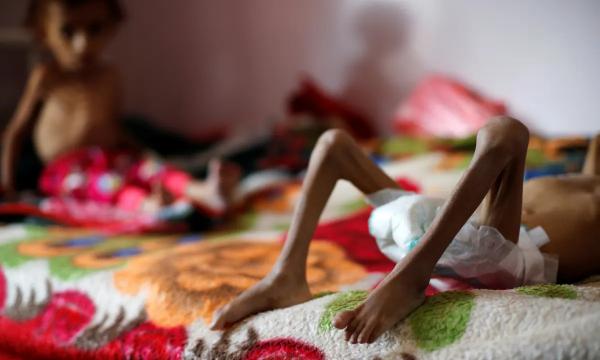 عامان على ولادة الفشل الحكومي.. ملايين اليمنيين يسحقون اقتصادياً بين فكي الانهيار والإقصاء