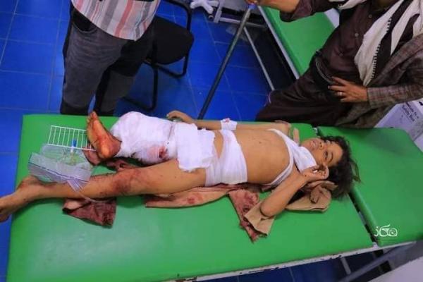 إصابة ثلاثة أطفال في قصف حوثي على حي سكني غربي تعز