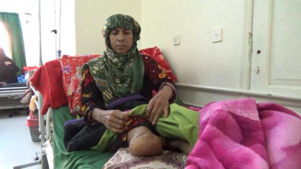 إصابة امرأة بانفجار لغم حوثي في تعز