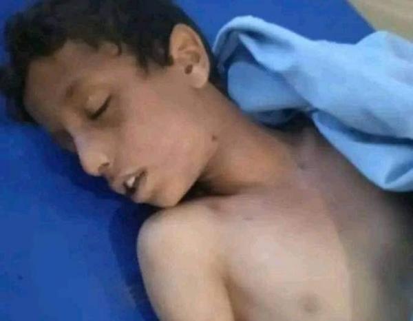 العثور على جثة رجل في إب وأخرى لطفل في مناطق سيطرة الحوثي في تعز