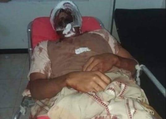 تعز.. استشهاد بائع أسماك برصاص مشرف حوثي