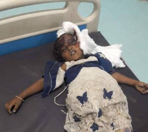 مجزرة جديدة يرتكبها الحوثيون في مقبنة غرب تعز
