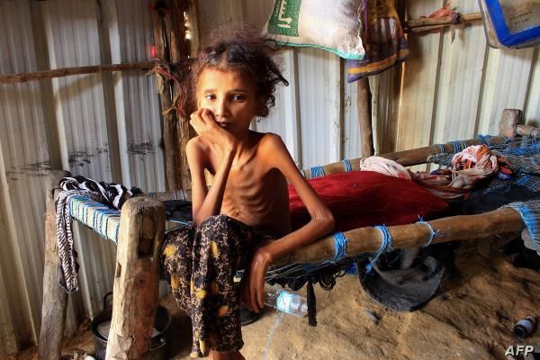 توقعات أممية بتفاقم إضافي لأزمة انعدام الأمن الغذائي خلال الأشهر المقبلة في اليمن