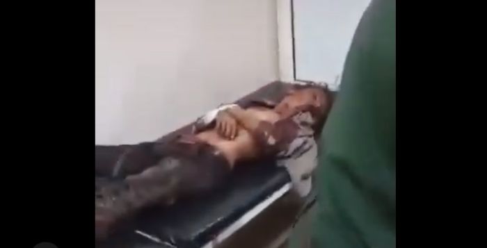 مقتل وإصابة 15 شخصاً على الأقل بانفجار قنبلة في حفل زفاف جنوبي تعز مقتل وإصابة 15 شخصاً على الأقل بانفجار قنبلة في حفل زفاف جنوبي تعز