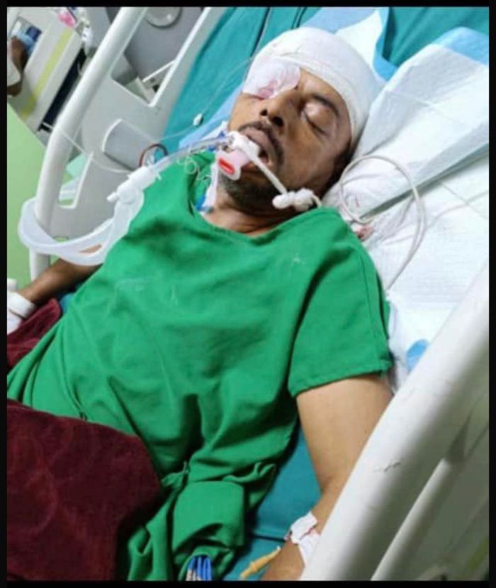 مسلح مجهول يصيب مواطناً برصاصة في رأسه بعد طرق باب منزله بعدن