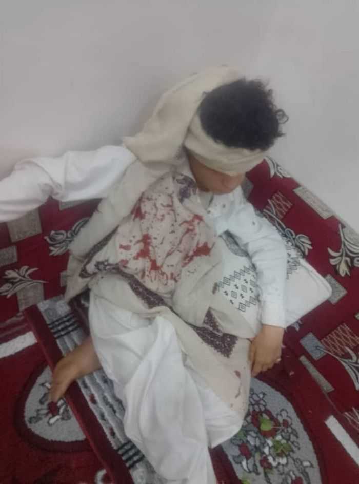 جريمتان مروّعتان بحق أطفال في عمران وصنعاء