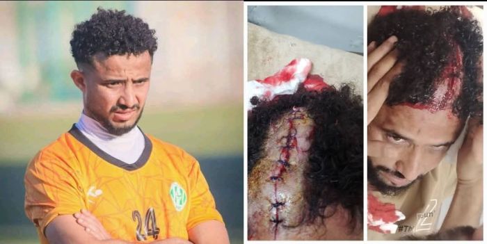 اعتداء وحشي يطول نجم ناديي أهلي تعز والميناء عدن داخل مطعم بمدينة تعز