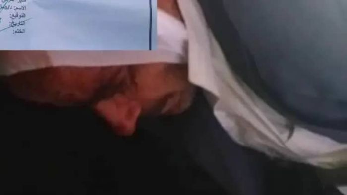 اعتداء وحشي على مواطن يعاني من اضطرابات نفسية في إب