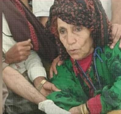 إصابة امرأتين برصاص قناصة مليشيا الحوثي جنوبي تعز