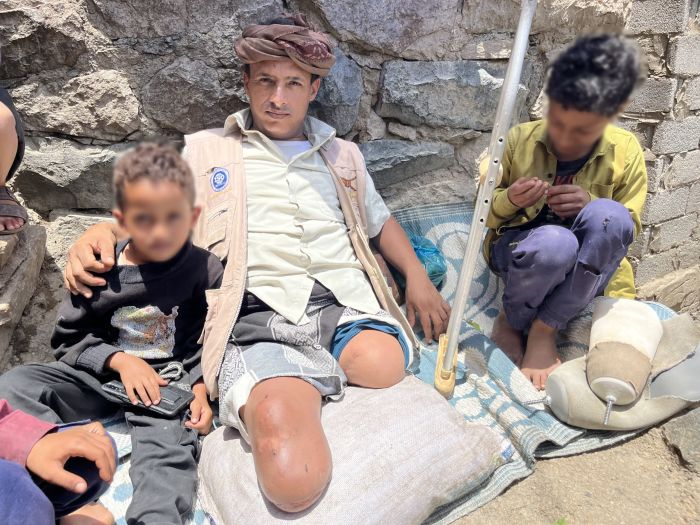 تقرير أممي: الألغام الحوثية تحصد أرواح 9 مدنيين في الحديدة خلال 3 أشهر