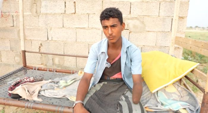 طفل من حجة يروي فاجعته مع ألغام الحوثي: ظننتها لعبة فانفجرت بين يدي