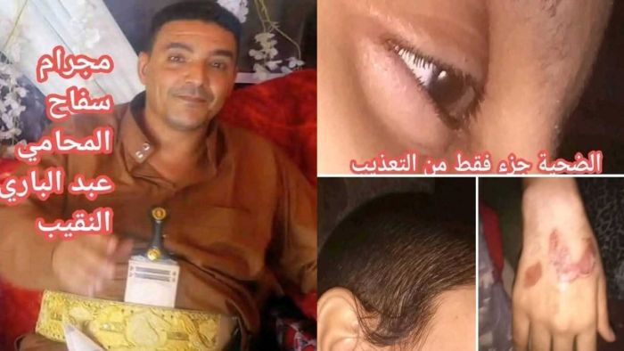 ناشطون: محامٍ في الحوبان بتعز يحتجز زوجته ويعذبها بوحشية منذ 8 أشهر