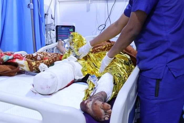 تعز.. إصابة 4 مدنيين بانفجار لغمين من مخلفات الحوثيين في ذو باب 
