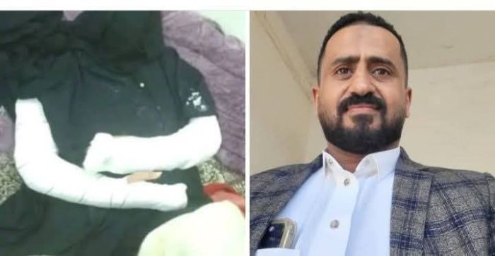 محامية تتعرض للضرب والتهديد بالقتل في تعز
