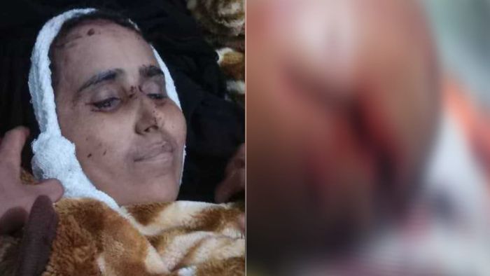 وفاة امرأة وإصابة محامٍ في حادثي اعتداء منفصلين بتعز والضالع