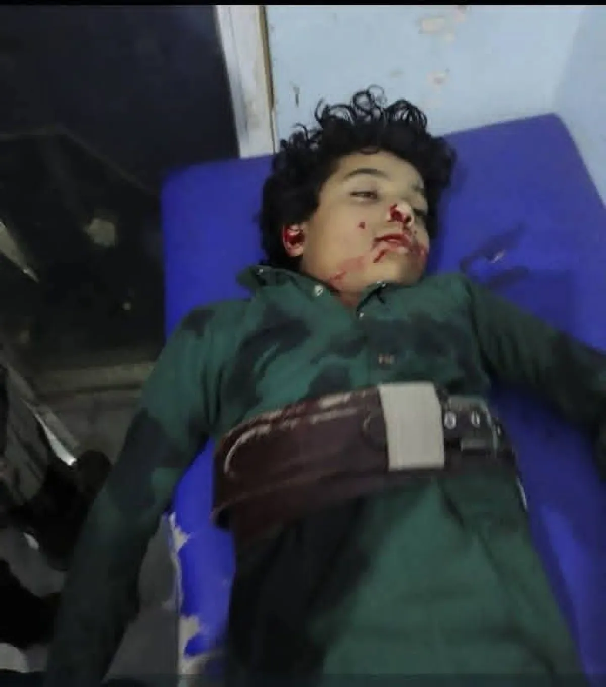 مقتل طفل برصاص مسلح حوثي في إب