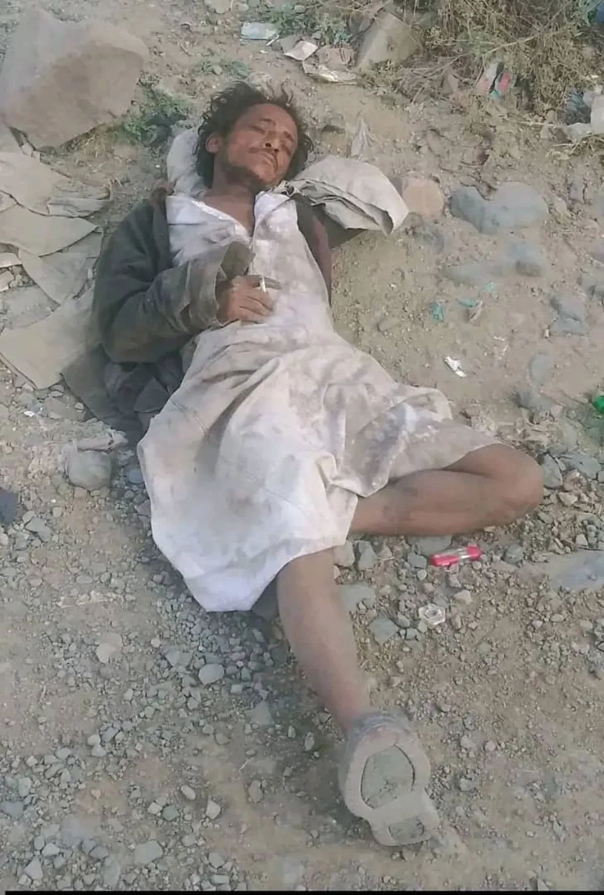 المختلون عقلياً في اليمن.. ظاهرة تتفاقم بين الحرب والانهيار الاقتصادي وغياب الرعاية