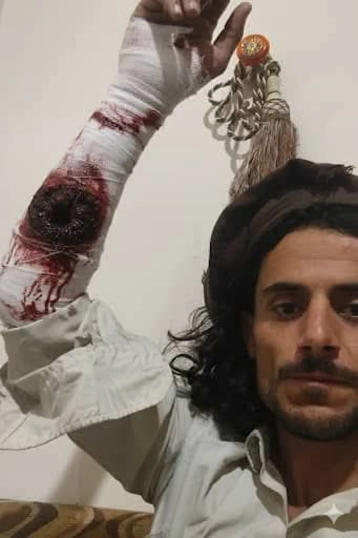 البيضاء.. مليشيا الحوثي تفرض حصاراً على منزل شاب في مدينة رداع