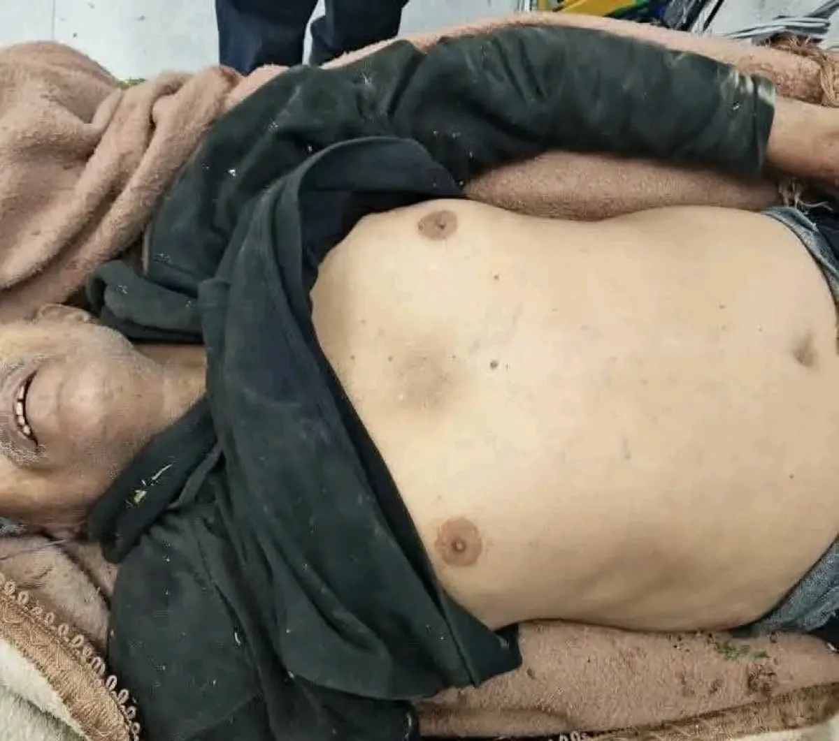 استشهاد مدني مسن برصاص قناص حوثي في حي الزهراء شرقي تعز