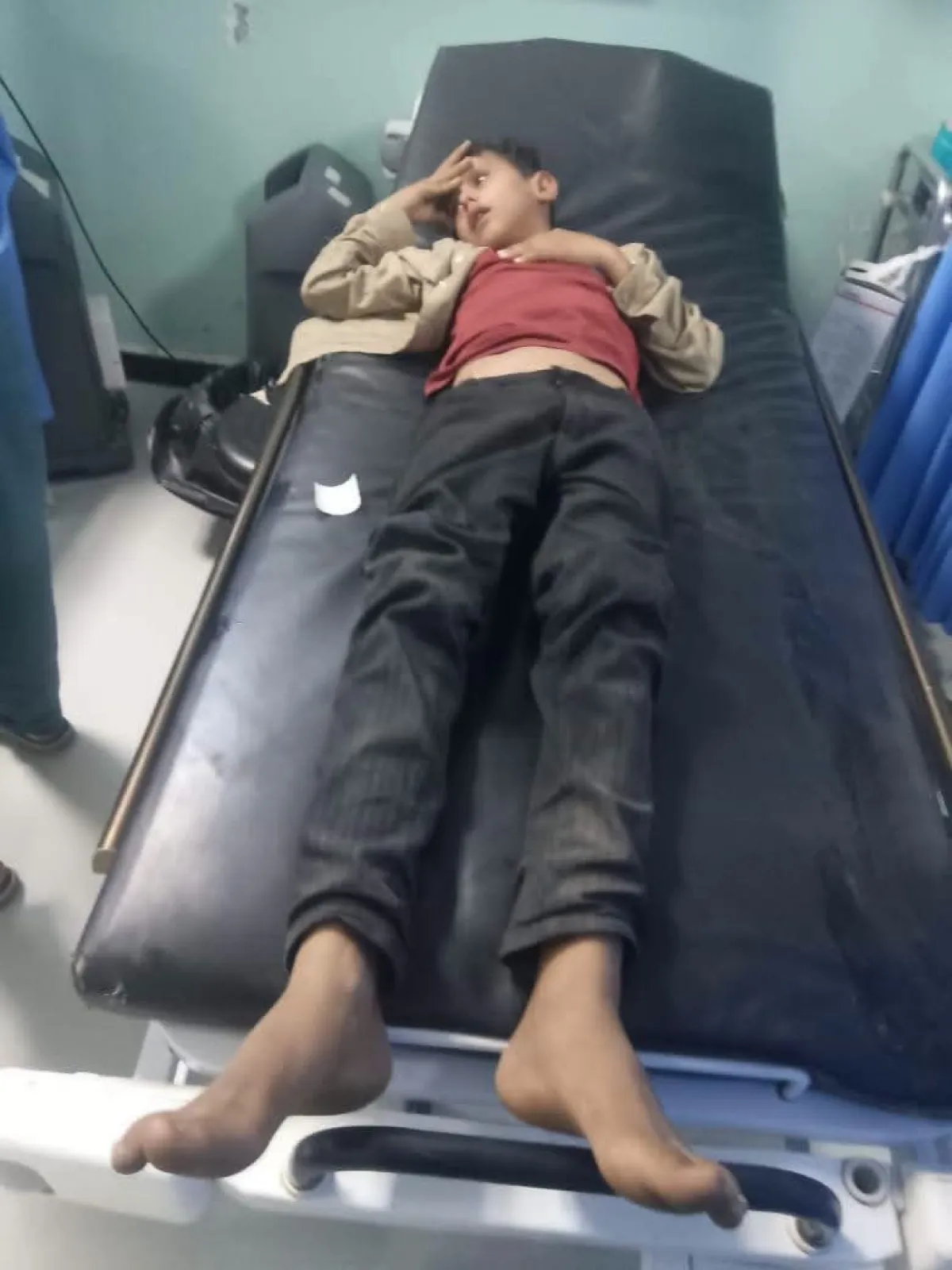 الضالع: مقتل وإصابة 17 طفلاً إثر انفجار جسم متفجر من مخلفات مليشيا الحوثي في حجر