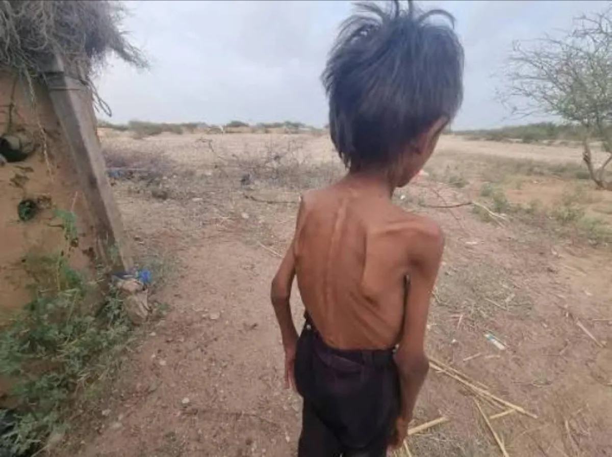 الغليان تحت الرماد.. هل تقود سياسة الإفقار الحوثية إلى 