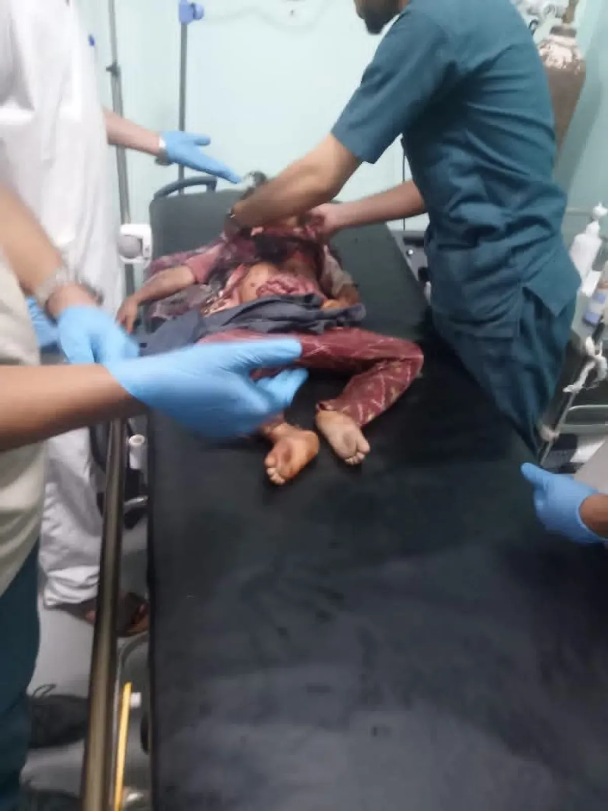 UNICEF Urges Accelerated Mine Clearance in Yemen After Children's Deaths | وكالة خبر للأنباء