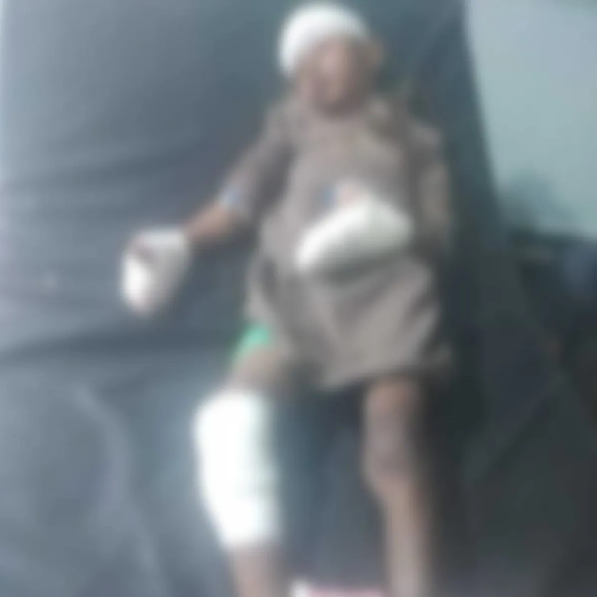 الحديدة.. إصابة طفل بجروح بالغة إثر انفجار لغم من مخلفات الحوثيين في حيس