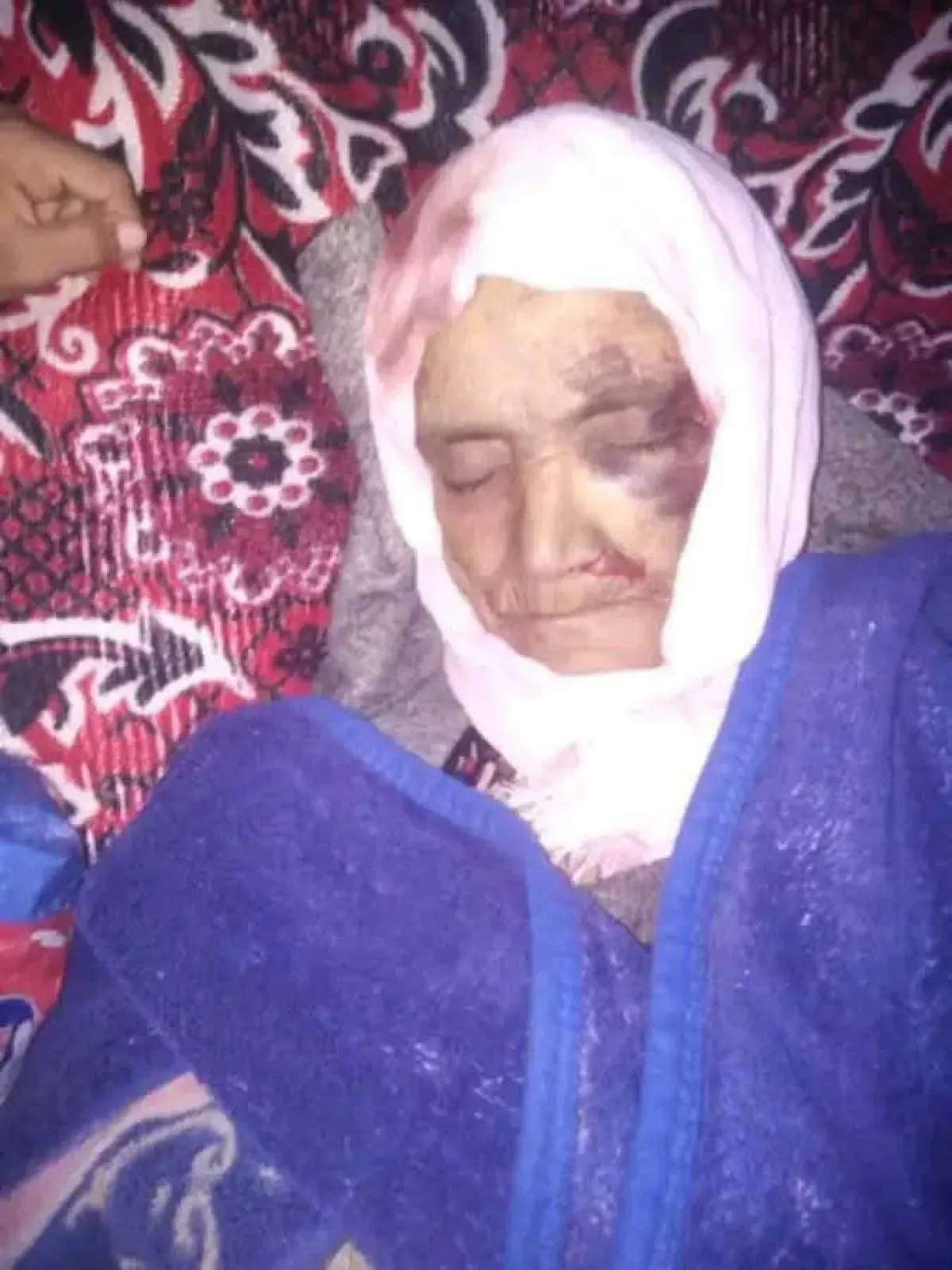 Elderly Woman Dies, Daughter Injured in Yemen Home Collapse After Heavy Rains