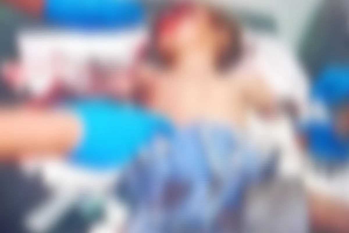 إصابة طفلة بانفجار عبوة ناسفة من مخلفات الحوثيين في الضالع
